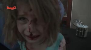 ‘피로 얼룩진 소녀 영상’ 시리아 참상 온몸으로 전해